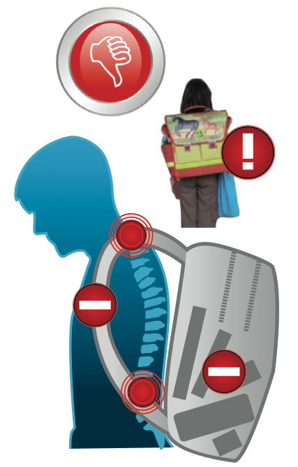 Nesprávné nastavení batohu